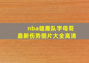 nba雄鹿队字母哥最新伤势图片大全高清