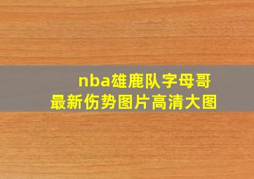 nba雄鹿队字母哥最新伤势图片高清大图