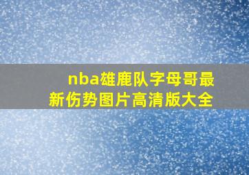 nba雄鹿队字母哥最新伤势图片高清版大全