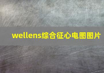 wellens综合征心电图图片