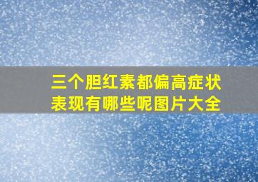 三个胆红素都偏高症状表现有哪些呢图片大全