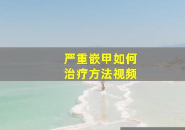 严重嵌甲如何治疗方法视频