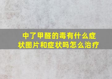 中了甲醛的毒有什么症状图片和症状吗怎么治疗