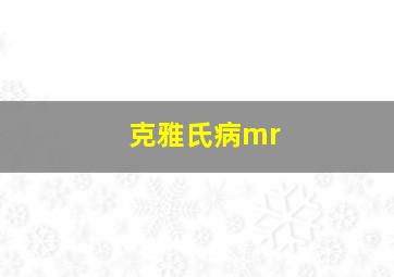 克雅氏病mr