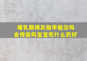 哺乳期得灰指甲能治吗会传染吗宝宝吃什么药好