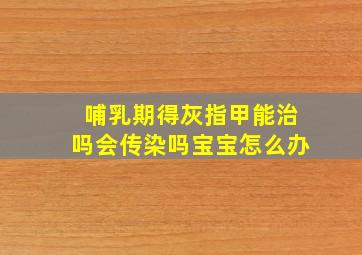 哺乳期得灰指甲能治吗会传染吗宝宝怎么办