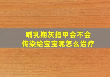 哺乳期灰指甲会不会传染给宝宝呢怎么治疗