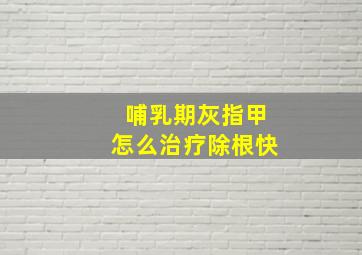 哺乳期灰指甲怎么治疗除根快