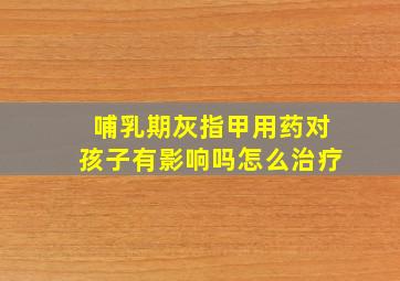 哺乳期灰指甲用药对孩子有影响吗怎么治疗