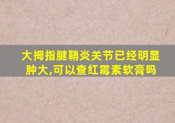 大拇指腱鞘炎关节已经明显肿大,可以查红霉素软膏吗