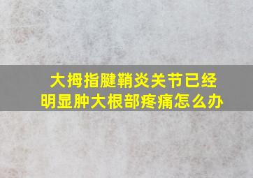 大拇指腱鞘炎关节已经明显肿大根部疼痛怎么办