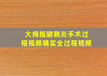 大拇指腱鞘炎手术过程视频确实全过程视频