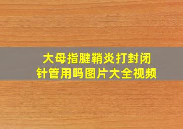 大母指腱鞘炎打封闭针管用吗图片大全视频