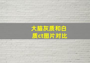 大脑灰质和白质ct图片对比