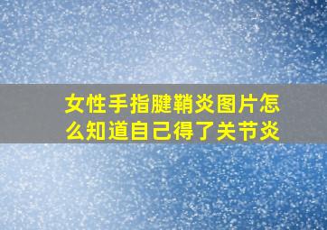 女性手指腱鞘炎图片怎么知道自己得了关节炎