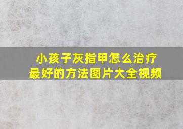 小孩子灰指甲怎么治疗最好的方法图片大全视频