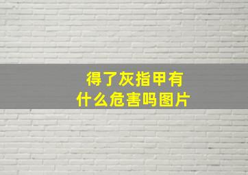 得了灰指甲有什么危害吗图片