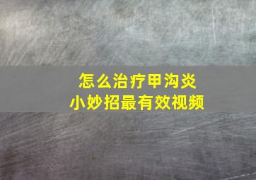 怎么治疗甲沟炎小妙招最有效视频