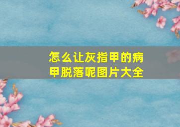 怎么让灰指甲的病甲脱落呢图片大全