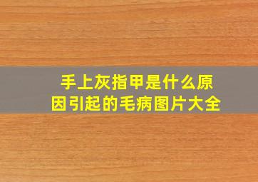 手上灰指甲是什么原因引起的毛病图片大全