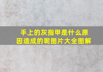 手上的灰指甲是什么原因造成的呢图片大全图解