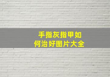 手指灰指甲如何治好图片大全