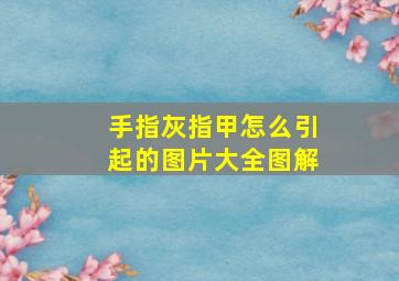 手指灰指甲怎么引起的图片大全图解