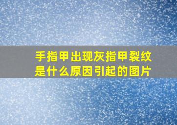 手指甲出现灰指甲裂纹是什么原因引起的图片