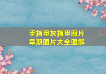 手指甲灰指甲图片早期图片大全图解