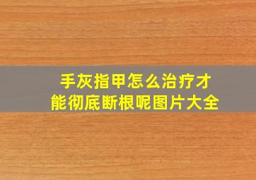 手灰指甲怎么治疗才能彻底断根呢图片大全