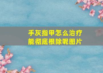 手灰指甲怎么治疗能彻底根除呢图片