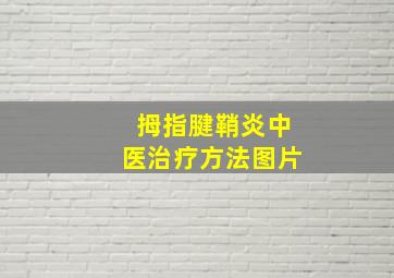 拇指腱鞘炎中医治疗方法图片