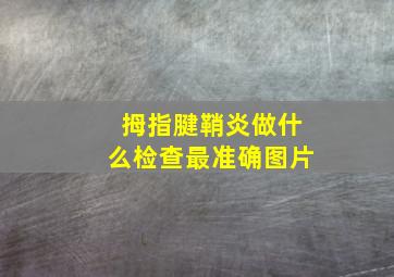 拇指腱鞘炎做什么检查最准确图片