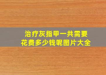 治疗灰指甲一共需要花费多少钱呢图片大全