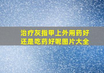 治疗灰指甲上外用药好还是吃药好呢图片大全