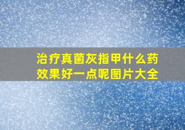 治疗真菌灰指甲什么药效果好一点呢图片大全