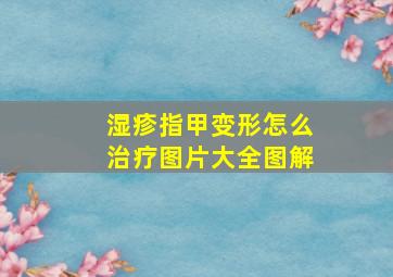 湿疹指甲变形怎么治疗图片大全图解