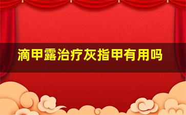 滴甲露治疗灰指甲有用吗