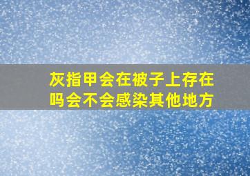 灰指甲会在被子上存在吗会不会感染其他地方