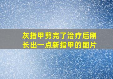 灰指甲剪完了治疗后刚长出一点新指甲的图片