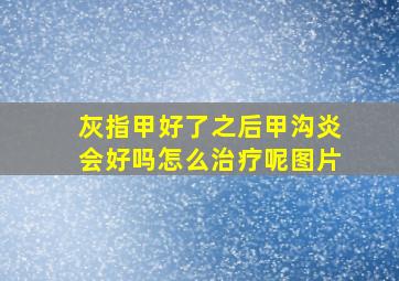 灰指甲好了之后甲沟炎会好吗怎么治疗呢图片