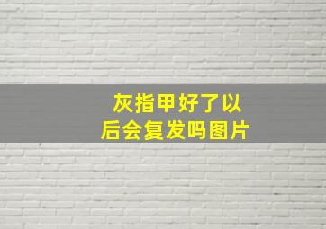 灰指甲好了以后会复发吗图片