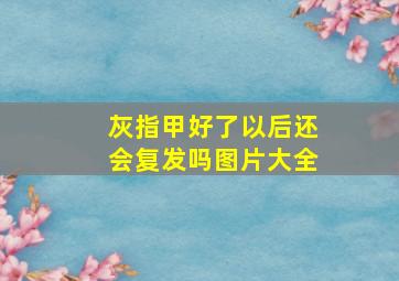 灰指甲好了以后还会复发吗图片大全