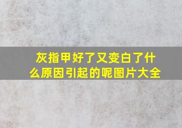 灰指甲好了又变白了什么原因引起的呢图片大全