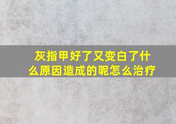 灰指甲好了又变白了什么原因造成的呢怎么治疗