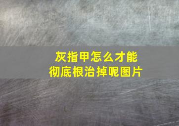 灰指甲怎么才能彻底根治掉呢图片