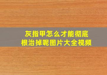 灰指甲怎么才能彻底根治掉呢图片大全视频