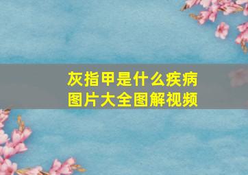 灰指甲是什么疾病图片大全图解视频