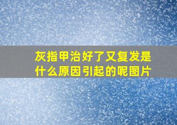 灰指甲治好了又复发是什么原因引起的呢图片