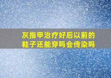 灰指甲治疗好后以前的鞋子还能穿吗会传染吗